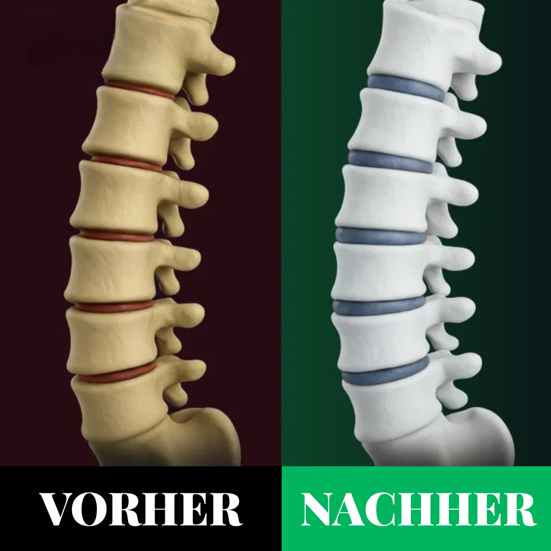 OrthoFlex™ Pro